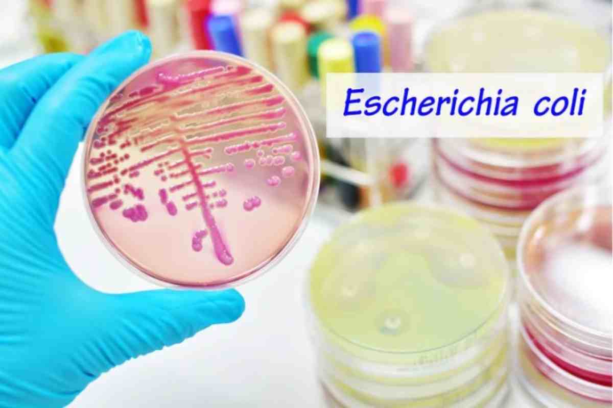 Escherichia coli in laboratorio